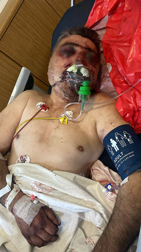 A boxer tries to bite a taxi driver's nose in 'monstrous attack' and faces 33 years in prison