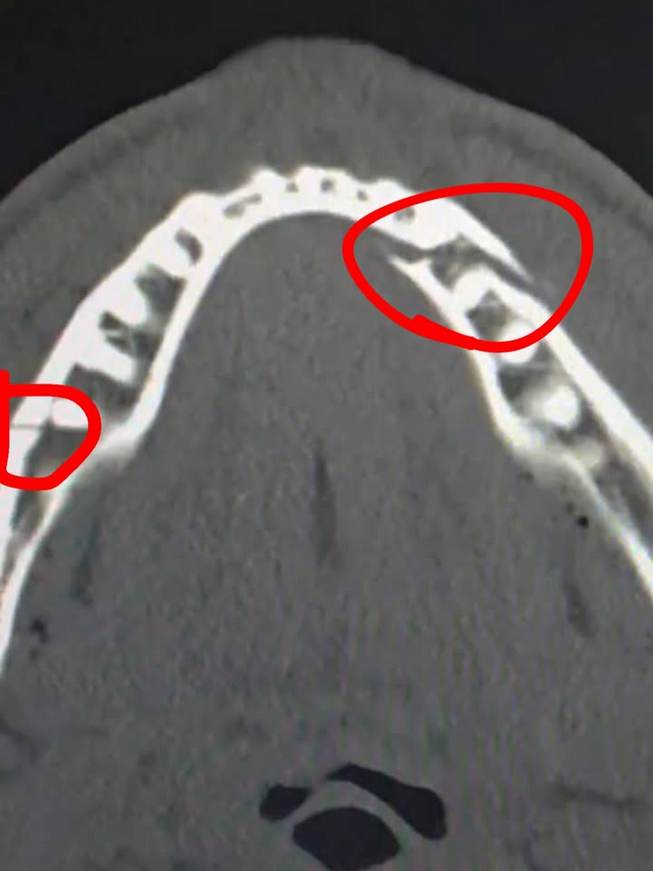 Jake Paul shows off the "failure" of his "American dream": broken jaw, $160 million, bills and guns