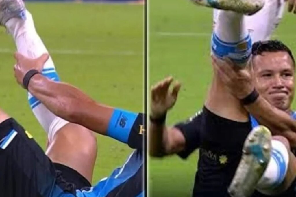 Brutal injury in Brazil: Marlon is left with his ankle hanging after suffering a serious fracture