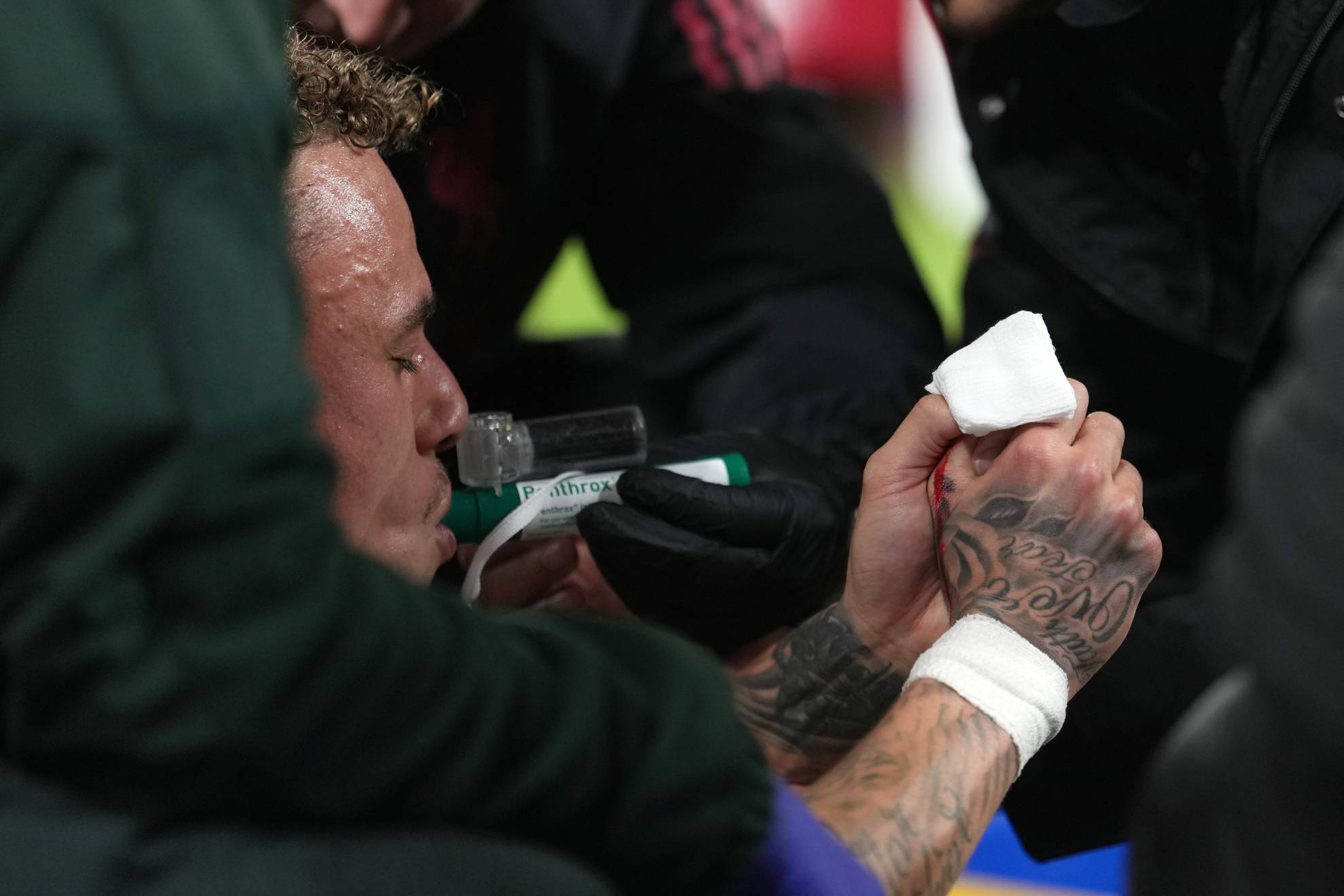 Terror at Anfield: Noa Lang suffers partial amputation of a finger after getting caught on a fence