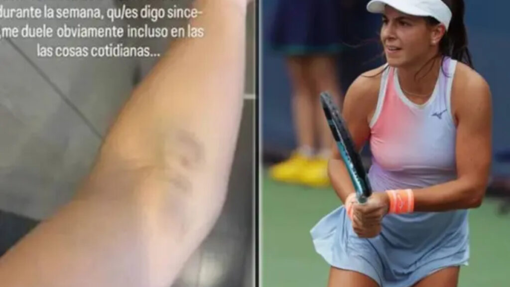 A “painful” bruise caused by an anti-doping test knocks out a tennis player: “She couldn’t find the vein…”