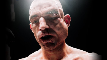 The photo that sums up the brutality of bare-knuckle boxing: this is how Ste Wallwork ended up after two rounds